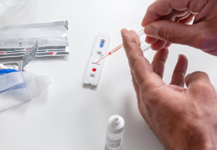 Hands performing a lab test with a small diagnostic kit on a clean white surface